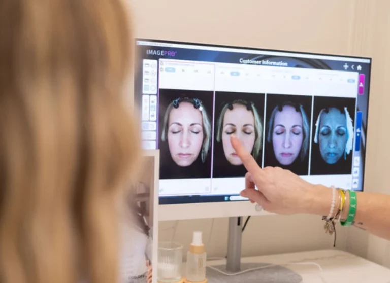 Skin specialist showing Helix CO₂ before-and-after skin analysis