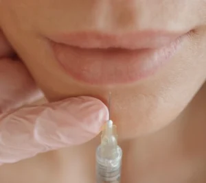 natural filler in sylvania and bloomfield hills